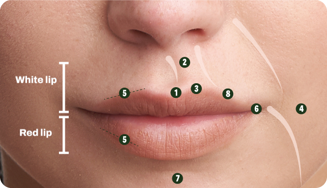 Lip-Flip-Injection-Points