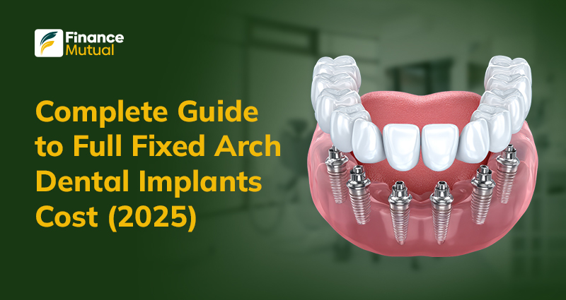 Full-Fixed-Arch-Dental-Implants-Cost