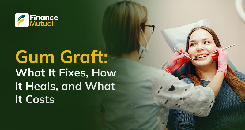 Gum-Graft-What-It-Fixes,-How-It-Heals