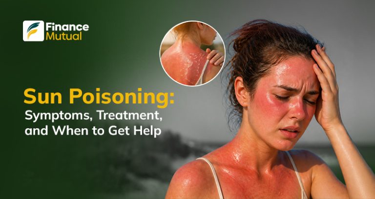 Juvinal Solar Rash Sun Poisoning: Symptoms, Treatment, and When to Get Help